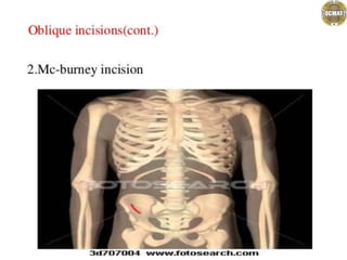 .................abdominal incisions.pptx
