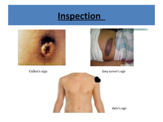 Inspection
Cullen’s Sign
Grey Turner’s Sign
 