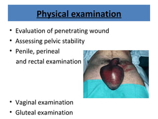Physical examination
• Evaluation of penetrating wound
• Assessing pelvic stability
• Penile, perineal
and rectal examination
• Vaginal examination
• Gluteal examination
 