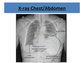 X-ray Chest/Abdomen
 
