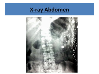 X-ray Abdomen
 