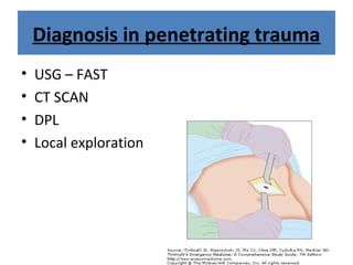 Diagnosis in penetrating trauma
• USG – FAST
• CT SCAN
• DPL
• Local exploration
 