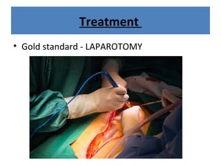 Treatment
• Gold standard - LAPAROTOMY
 