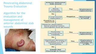 Penetrating Abdominal
Trauma Evaluation
Algorithm for the
evaluation and
management of
anterior abdominal stab
wounds
 