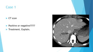 Case 1
 CT scan
 Positive or negative?????
 Treatment. Explain.
 