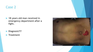 Case 2
 18 years old man received in
emergency department after a
fight.
 Diagnosis???
 Treatment
 