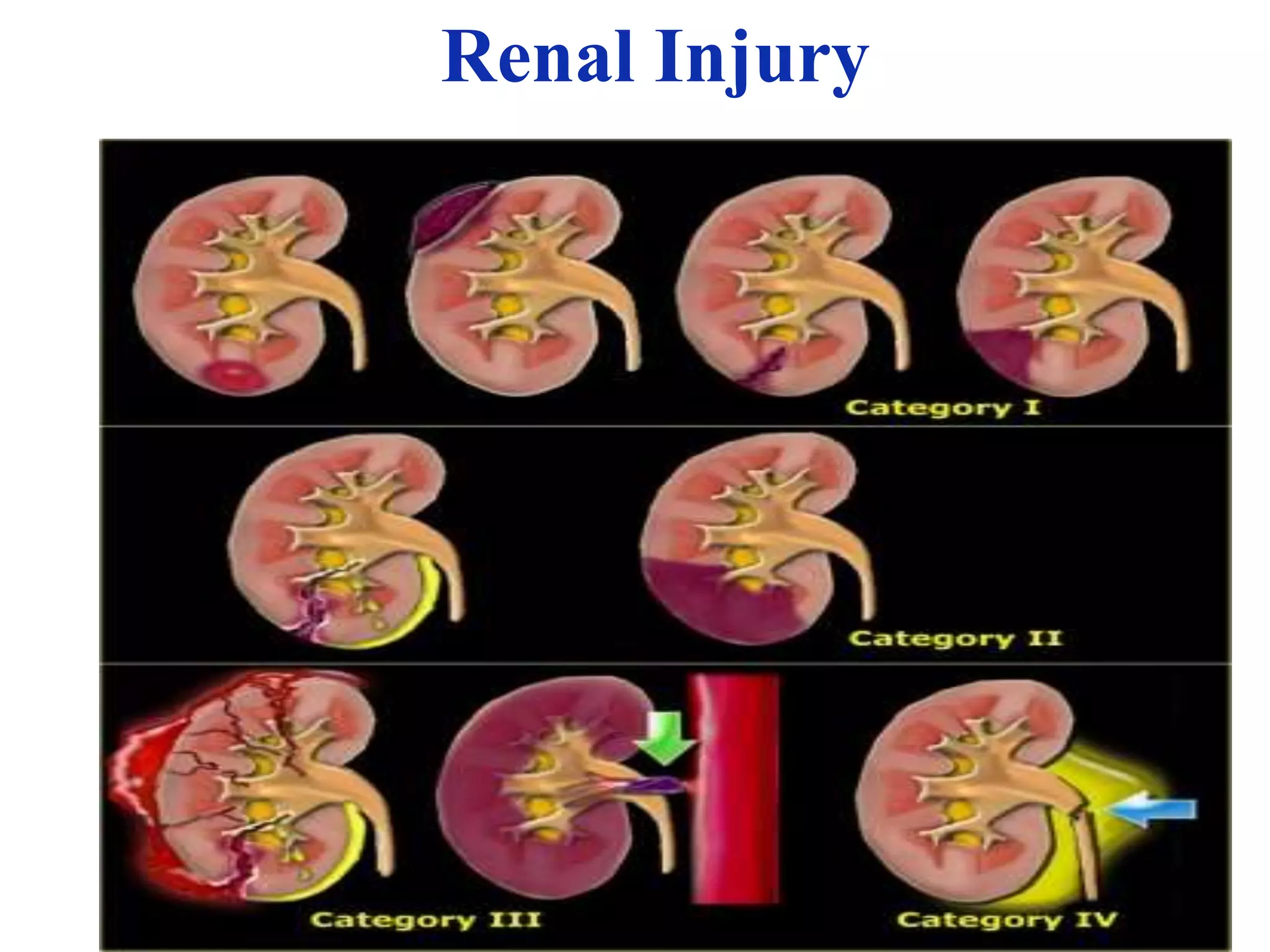 Abdominal injury | PPTX