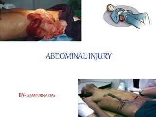 ABDOMINAL INJURY
BY- SAMPURNA DAS
 