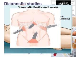 Diagnostic studies
• CECT
• FAST
• DPL
• Complete blood count
• Blood glucose determination
• Urinanalysis
• Coagulation profile
• Blood grouping, typing &
cross matching
• Arterial blood gas analysis
 