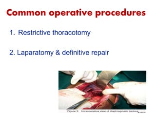 Common operative procedures
1. Restrictive thoracotomy
2. Laparatomy & definitive repair
 
