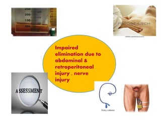 Impaired
elimination due to
abdominal &
retroperitoneal
injury , nerve
injury
 