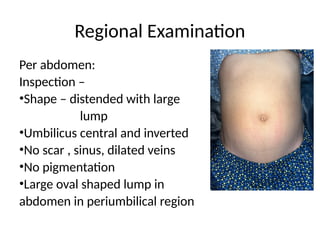 Comprehensive Case Study on Diagnosis and Examination of Abdominal Lump ...