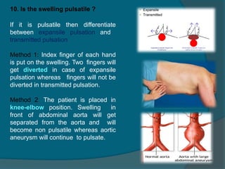 Abdominal lump examination for general surgery students .pptx