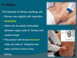 Abdominal lump examination for general surgery students .pptx