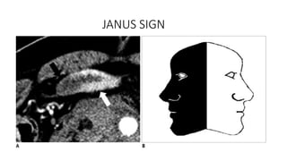 Janitoral Note Sign abdominal trauma in the radiology department | PPTX