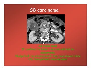 GB carcinoma
GB fossa mass
If confined to lumen – mucosa will not be
discernible.
Sludge ball: no enhancement; may have moved since
US; turn patient; mucosa seen
 