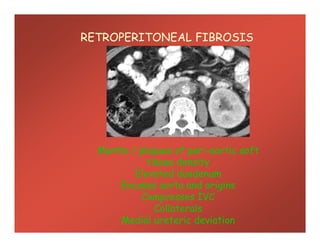 RETROPERITONEAL FIBROSIS
Mantle / plaques of peri-aortic soft
tissue density
Elevated duodenum
Encases aorta and origins
Compresses IVC
Collaterals
Medial ureteric deviation
 