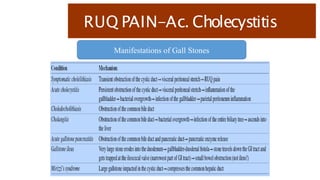 RUQ PAIN-Ac. Cholecystitis
Manifestations of Gall Stones
 