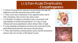 LLQ Pain-
AcuteDiverticulitis
-Etiopathogenesis
• l .Colonic diverticula are mucosal out pouchings through the
submucosa and the muscular layer of the colon.
• 2 .They occur most commonly in the sigmoid colon, and in
10% of patients, they involve the entire colon.
• 3.A disorder of modern civilization and is associated with
consumption of refined food products. It is rare in rural
African and Asian populations where dietary fiber is high.
• 4. Long standing constipation increases the stool transit time
and intraluminal pressure and causes diverticulosis.
• 5. They arise between antimesenteric taenia and the mesenteric
taenia at the site of entry of the blood vessels.
 