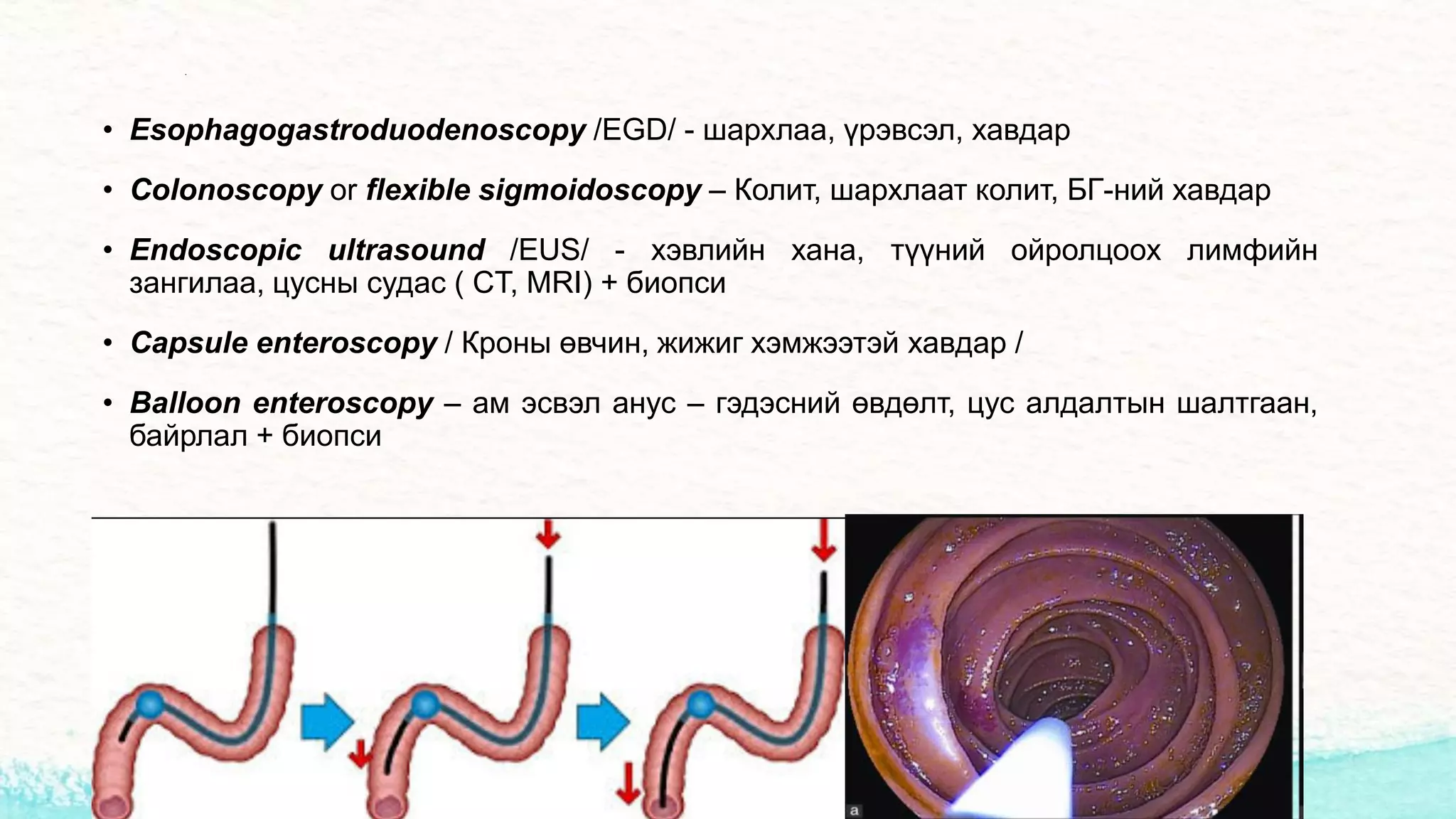 Хэвлийн өвдөлт | PPT