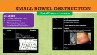 SMALL BOWEL OBSTRUCTION
Clinical Features- Symptoms
QUARTET
✓ Colicky abdominal pain
✓ Bilious vomiting
✓ Abdominal distension
✓ Constipation/Obstipation
 