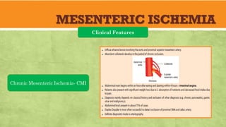 MESENTERIC ISCHEMIA
Clinical Features
Chronic Mesenteric Ischemia- CMI
 