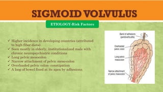 SIGMOIDVOLVULUS
ETIOLOGY-Risk Factors
✓ Higher incidence in developing countries (attributed
to high fiber diets)
✓ Seen mostly in elderly, institutionalized male with
chronic neuropsychiatric conditions
✓ Long pelvic mesocolon
✓ Narrow attachment of pelvic meso-colon
✓ Overloaded pelvic colon- constipation
✓ A loop of bowel fixed at its apex by adhesions.
 