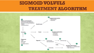 SIGMOIDVOLVULS
TREATMENT ALGORITHM
 