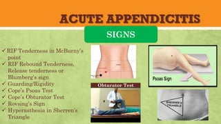 ACUTE APPENDICITIS
SIGNS
üRIF Tenderness in McBurny’s
point
ü RIF Rebound Tenderness,
Release tenderness or
Blumberg’s sign
ü Guarding/Rigidity
ü Cope’s Psoas Test
ü Cope’s Obturator Test
ü Rovsing’s Sign
ü Hyperasthesia in Sherren’s
Triangle
Obturator Test
 