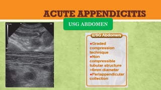 ACUTE APPENDICITIS
USG ABDOMEN
 