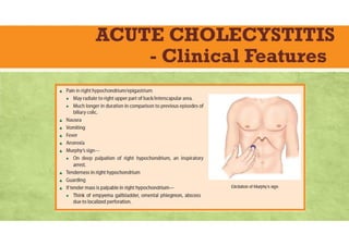 ACUTE CHOLECYSTITIS
- Clinical Features
 