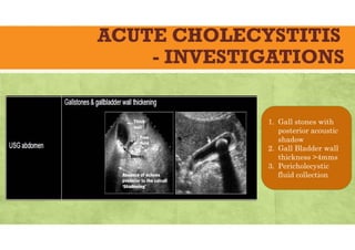 ACUTE CHOLECYSTITIS
- INVESTIGATIONS
1. Gall stones with
posterior acoustic
shadow
2. Gall Bladder wall
thickness >4mms
3. Pericholecystic
fluid collection
 