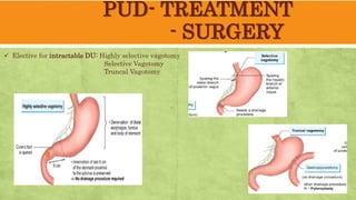 PUD- TREATMENT
- SURGERY
Elective for intractable DU: Highly selective vagotomy
Selective Vagotomy
Truncal Vagotomy
 