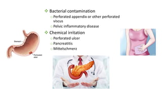  Bacterial contamination
oPerforated appendix or other perforated
viscus
oPelvic inflammatory disease
 Chemical irritation
oPerforated ulcer
oPancreatitis
oMittelschmerz
 
