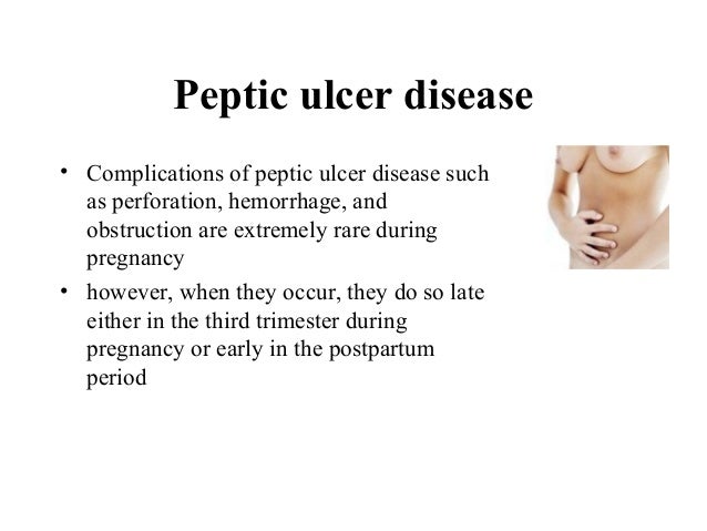 Abdominal pain during_pregnancy Abdominal pain during_pregnancy