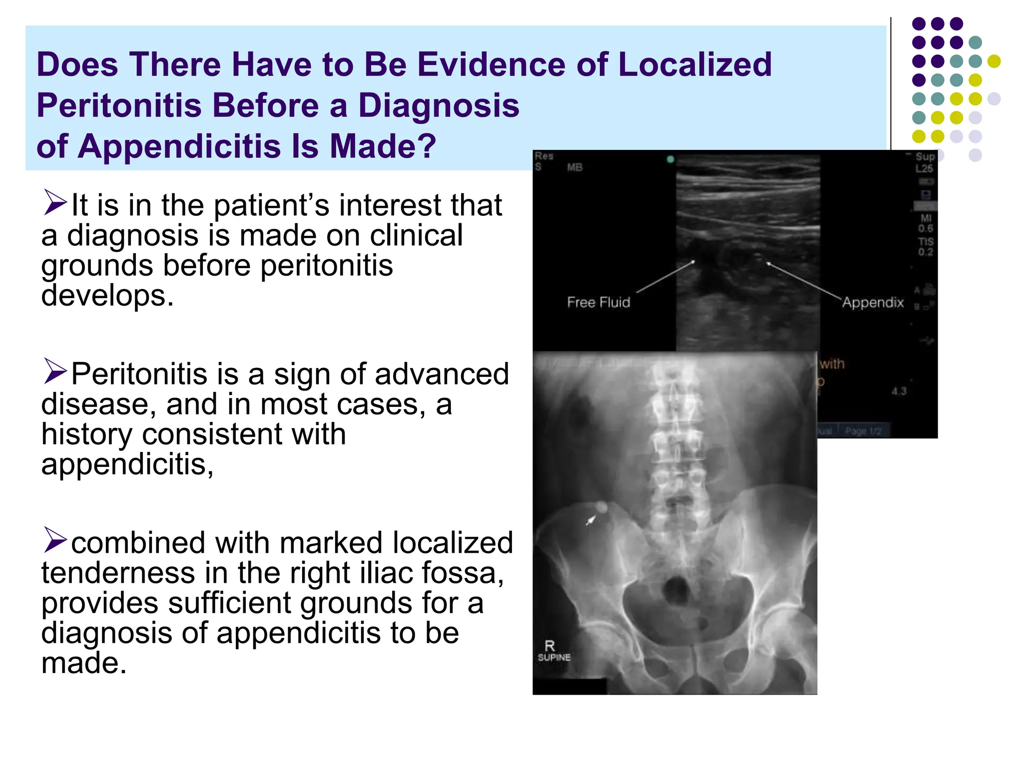 Abdominal pain in children - dr. Hermanto Sp.BA.pptx