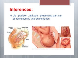 Inferences:
 Lie , position , attitude , presenting part can
be identified by this examination
 