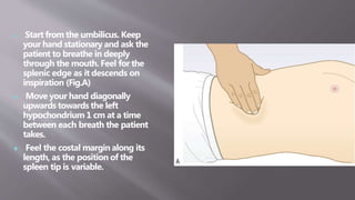  Start from the umbilicus. Keep
your hand stationary and ask the
patient to breathe in deeply
through the mouth. Feel for the
splenic edge as it descends on
inspiration (Fig.A)
 Move your hand diagonally
upwards towards the left
hypochondrium 1 cm at a time
between each breath the patient
takes.
 Feel the costal margin along its
length, as the position of the
spleen tip is variable.
 
