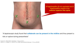 2 fngerbreadths (3 cm) cephalad and 2
fngerbreadths medial to the
anterior superior iliac spine
“A laparoscopic study found that collaterals can be present in the midline and thus present a
risk or rupture during paracentesis”
Runyon B. A., AASLD (2013), Hepatology, 57 (4), pp. 1651-3
Oelsner D. H., Caldwell S. H., Coles M., et al. (1998), Gastrointestinal Endoscopy, 47 (5), pp. 388-390
 