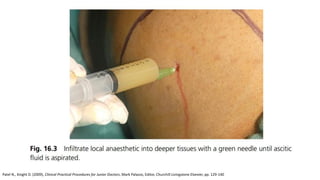 Patel N., Knight D. (2009), Clinical Practical Procedures for Junior Doctors, Mark Palazzo, Editor, Churchill Livingstone Elsevier, pp. 129-140
 