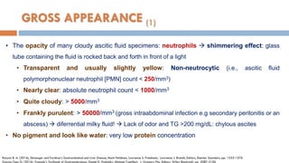 GROSS APPEARANCE (1)
• The opacity of many cloudy ascitic ﬂuid specimens: neutrophils  shimmering effect: glass
tube containing the ﬂuid is rocked back and forth in front of a light
• Transparent and usually slightly yellow: Non-neutrocytic (i.e., ascitic ﬂuid
polymorphonuclear neutrophil [PMN] count < 250/mm3)
• Nearly clear: absolute neutrophil count < 1000/mm3
• Quite cloudy: > 5000/mm3
• Frankly purulent: > 50000/mm3 (gross intraabdominal infection e.g secondary peritonitis or an
abscess)  diferrential milky fluid!  Lack of odor and TG >200 mg/dL: chylous ascites
• No pigment and look like water: very low protein concentration
Runyon B. A. (2016), Sleisenger and Fordtran’s Gastrointestinal and Liver Disease, Mark Feldman, Lawrence S. Friedman, Lawrence J. Brandt, Editors, Elsevier Saunders, pp. 1553-1576
Garcia-Tsao G. (2016), Yamada’s Textbook of Gastroenterology, Daniel K. Podolsky, Michael Camilleri, J. Gregory Fitz, Editors, Wiley Blackwell, pp. 2087-2106
 