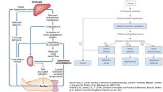 Garcia-Tsao G. (2016), Yamada’s Textbook of Gastroenterology, Daniel K. Podolsky, Michael Camilleri,
J. Gregory Fitz, Editors, Wiley Blackwell, pp. 2087-2106
Anstee Q. M., Jones D. E. J. (2014), Davidson's Principles and Practice of Medicines, Brian R. Walker,
et al., Editors, Churchill Livingstone, Elsevier, pp. 921-942
 
