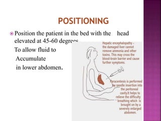Paracentesis Procedure