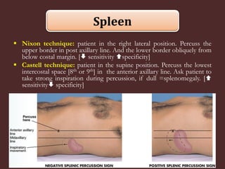 Abdominal percussion [2015] | PDF