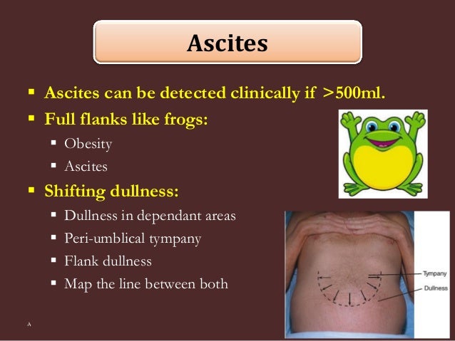 Abdominal percussion [2015]