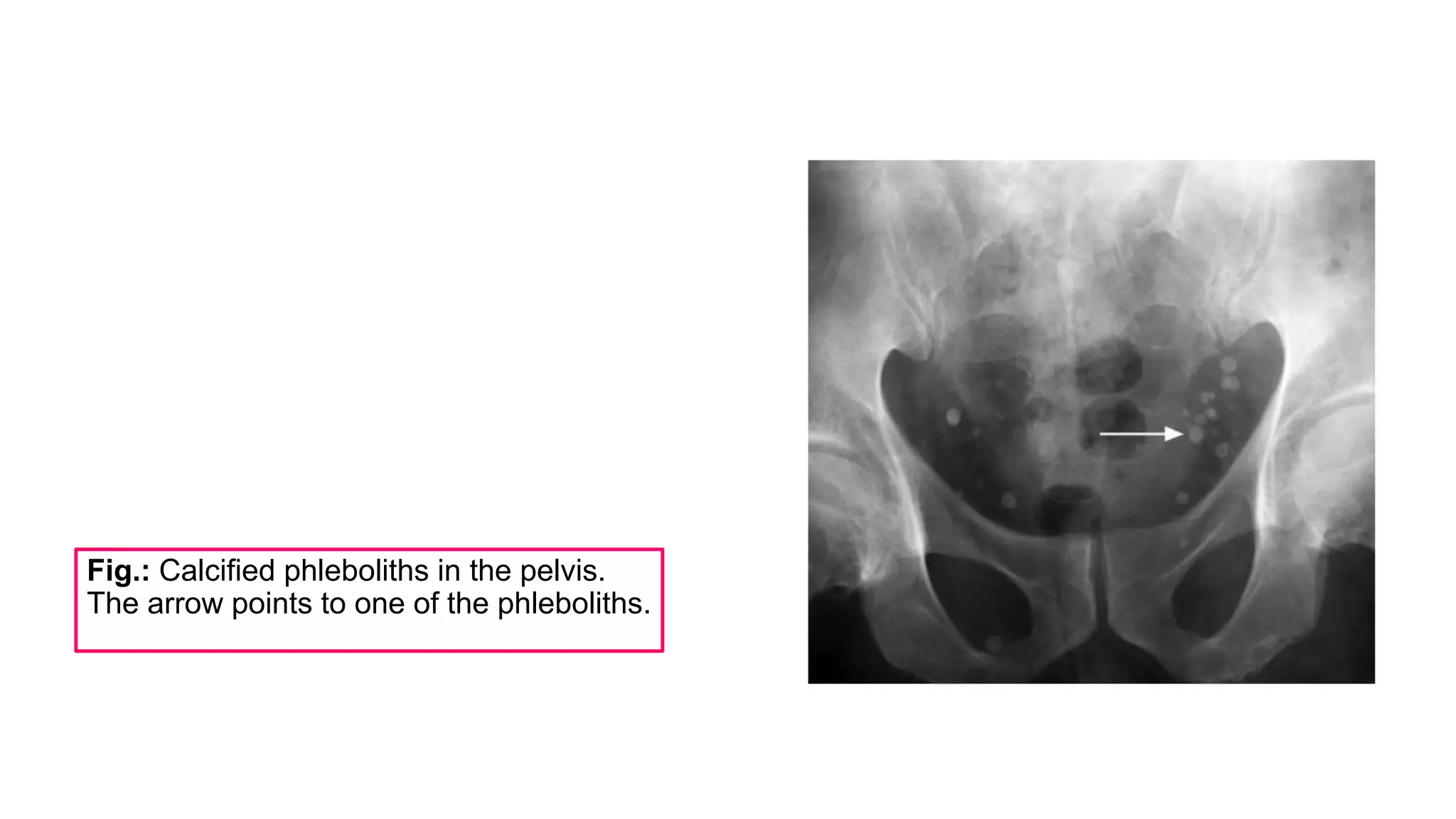 Abdominal Plain.pptx
