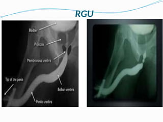 Abdominal Radiology - x-rays of abdomen | PPTX