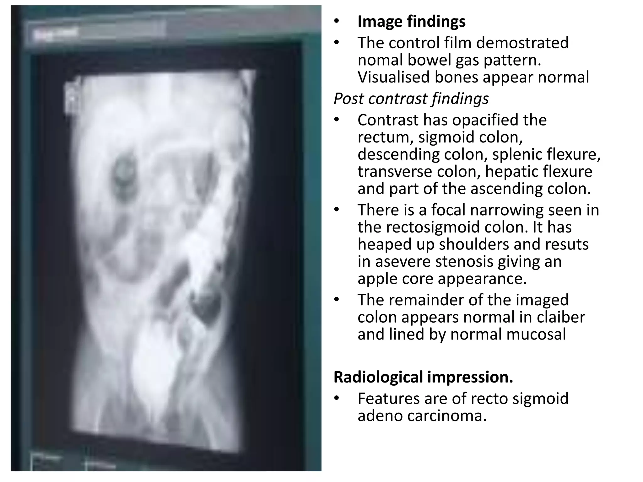 ABDOMINAL REPORT.pptx