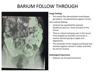 Eed Normal ABDOMINAL REPORT.pptx