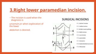 Abdominal surgeries physiotherapy management | PPTX
